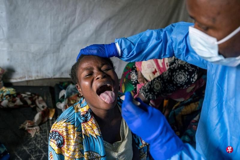 印度通报一疑似猴痘病例 患者已被隔离印度卫生部星期天（9月8日）说，当地出现一起疑似感染猴痘的病例，患者目前在医院隔离，情况稳定